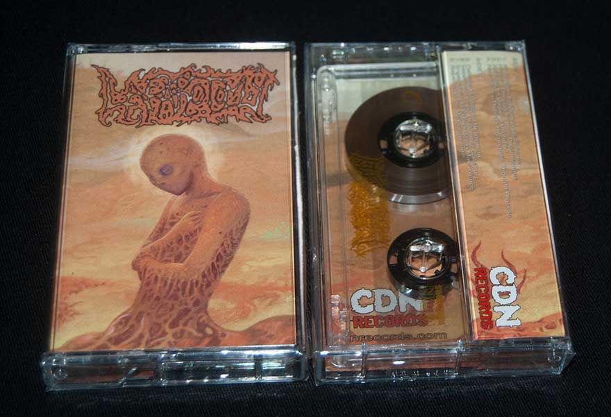 LAPAROTOMY  "Laparotomy - Ascendancy Through Hypnagogic Thought Process"