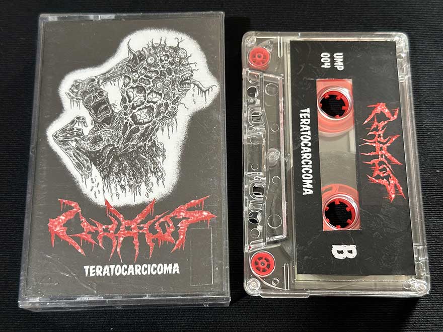 TERATOS  "Teratocarcicoma"